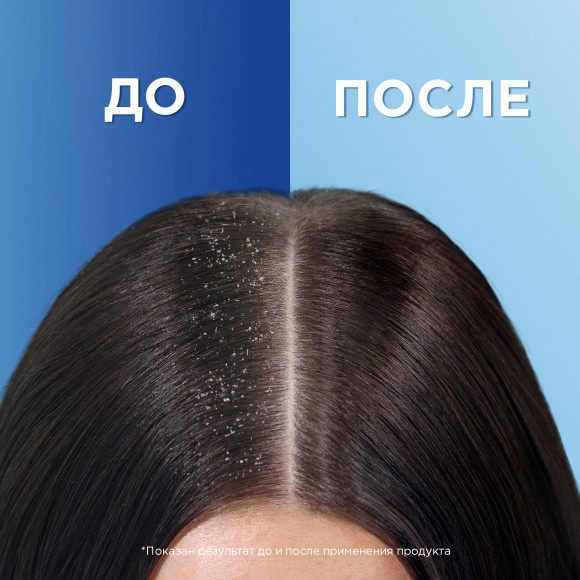 Шампунь против перхоти Head&Shoulders 2в1 основной уход, ХХL 900мл, 2шт